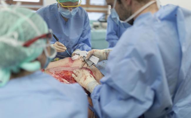 Hauttransplantation: Kantischülerin verfasst Maturaarbeit