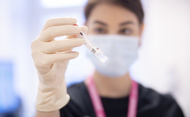 Regierung gegen Gratistests für Sex-Krankheiten