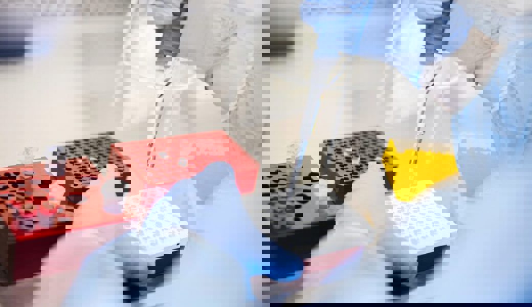  Am 8. März waren demnach über 60 von 100 im Kanton St. Gallen untersuchten Proben (PCR) positiv.<br />